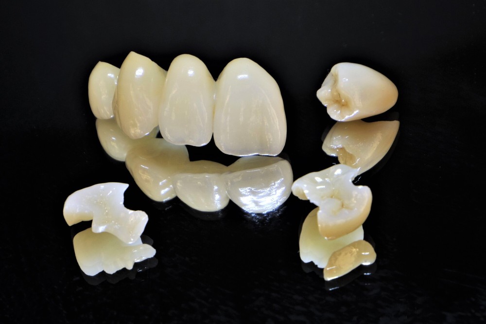 ハイブリッドレジン