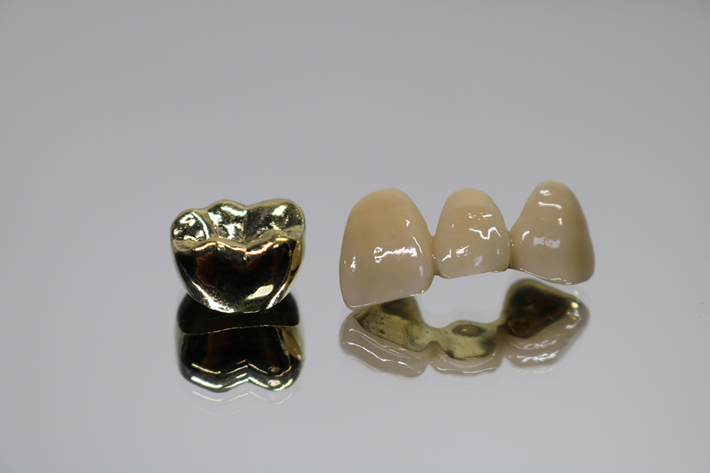 ゴールドクラウン